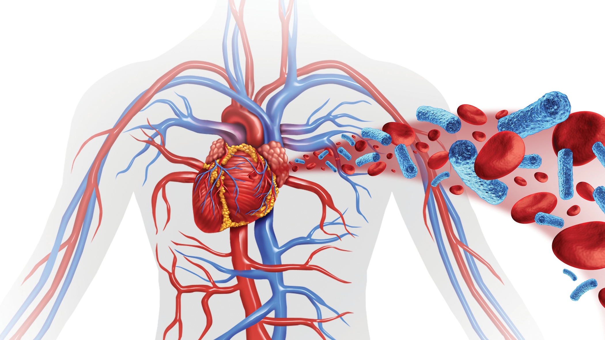 CLABSI Audit Report | Central Line–Associated Bloodstream Infection cover